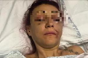 Lucia Regna: nessuna condanna nonostante il volto tumefatto